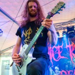 0320 Sodomized Cadaver
